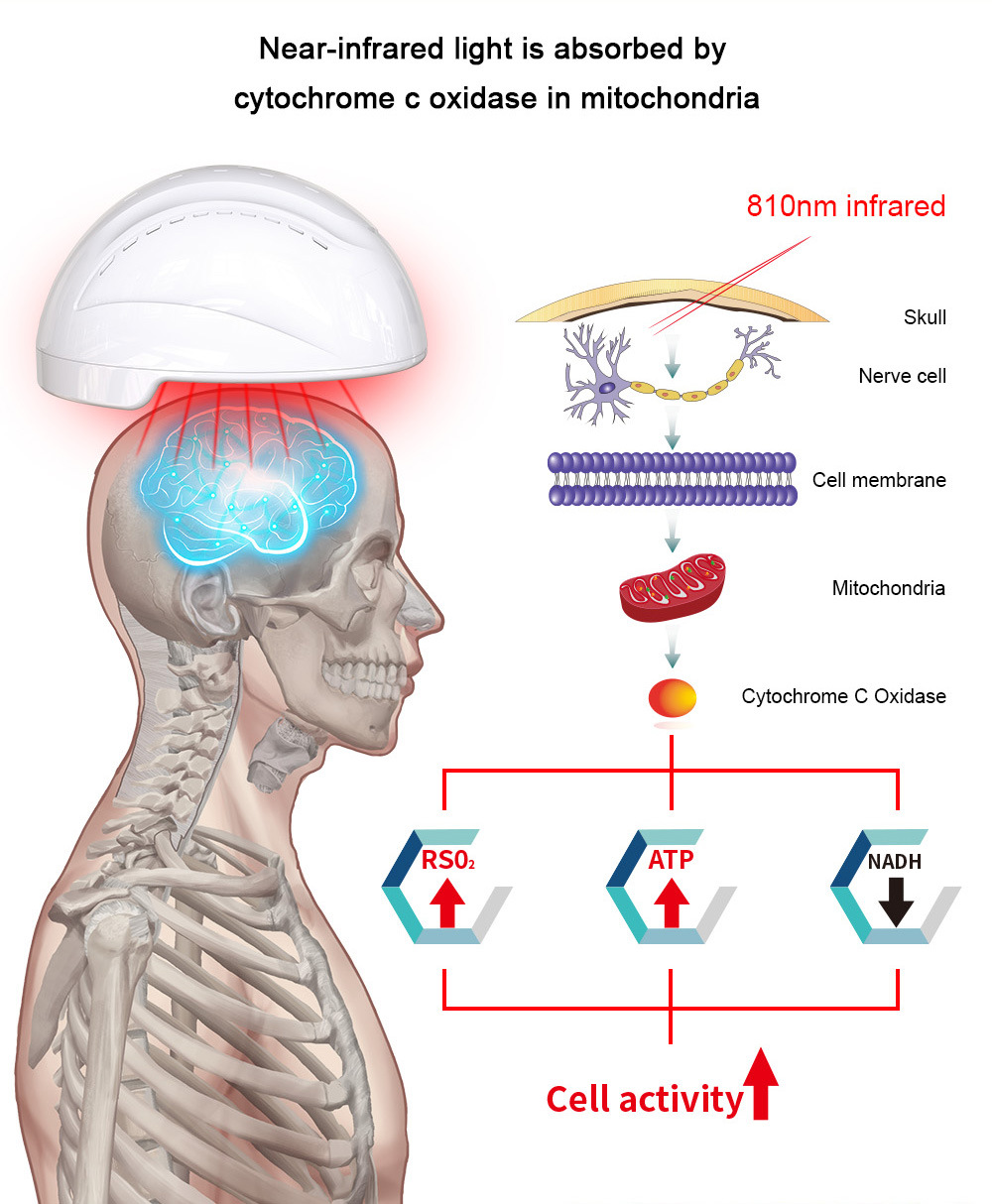 810nm Near Infrared Light Photobiomodulation Helmet Brain Therapy Euiqpment