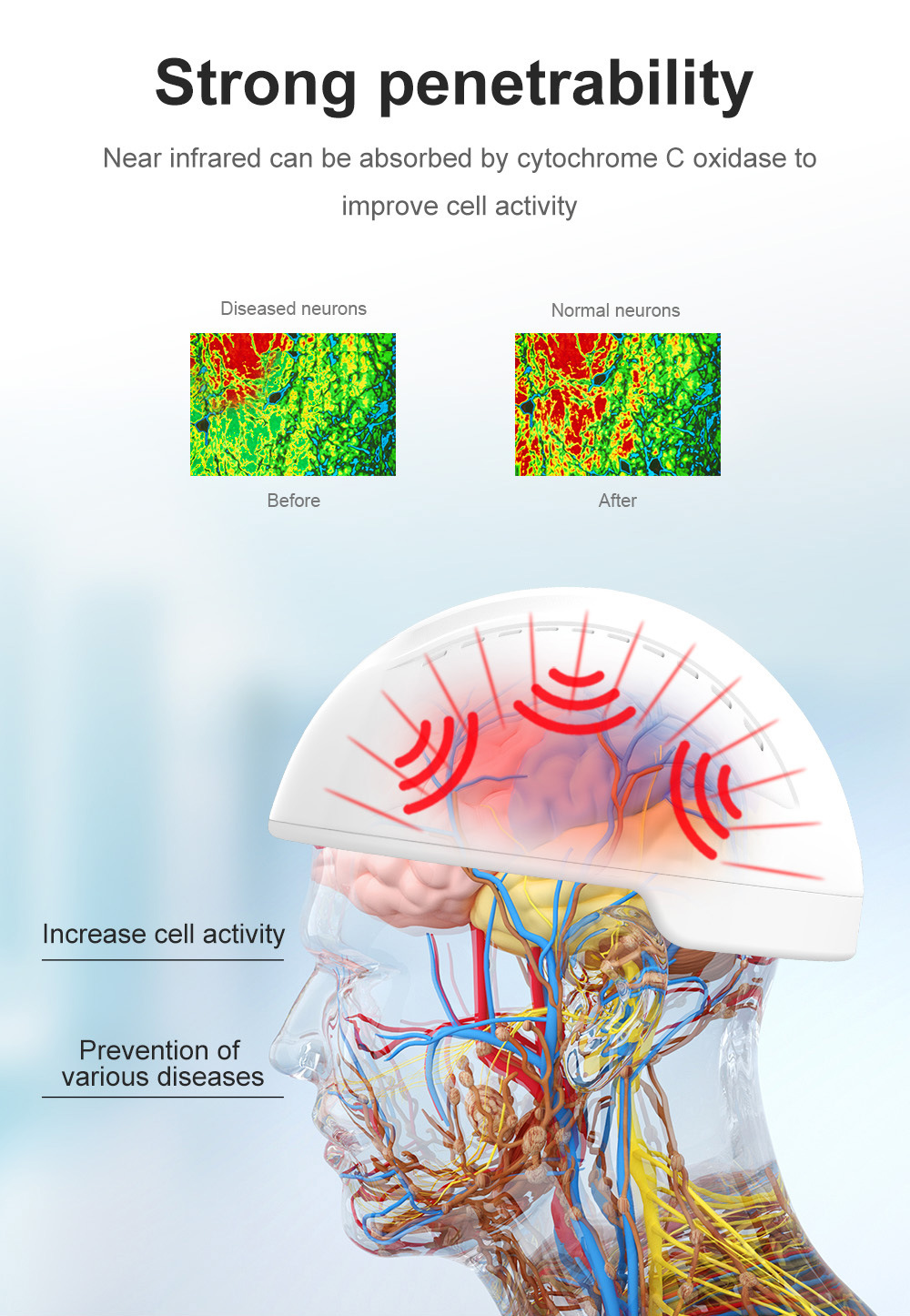 810nm Near Infrared Light Photobiomodulation Helmet Brain Therapy Euiqpment